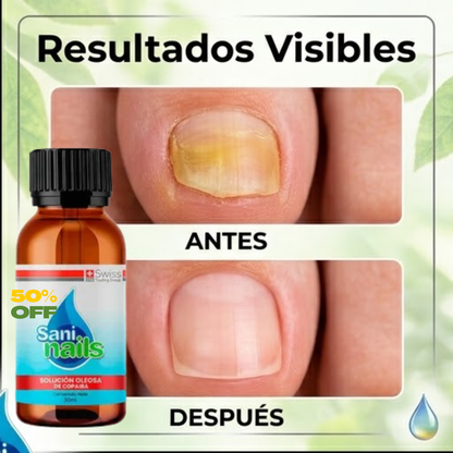 Saninails Gel Solución de reparación de uñas y uñas extra fuerte
