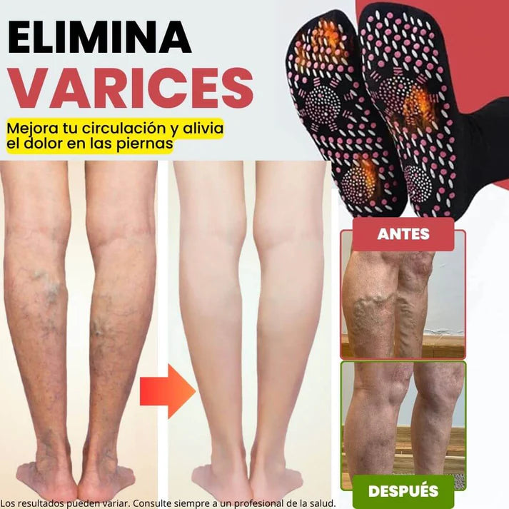 OFERTA ESPECIAL Calcetines de acupresión Anti-Varices🤯Alivia la Pesadez y el dolor